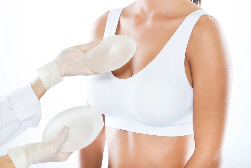 Implantaatide valik enne rindade suurendamise operatsiooni