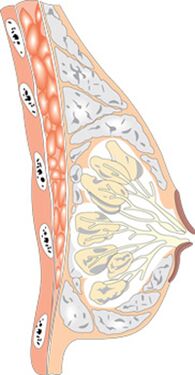 Naise rinna struktuur