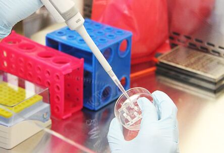 Patsiendi analüüside uurimine enne augmentatsiooni mammoplastika tegemist