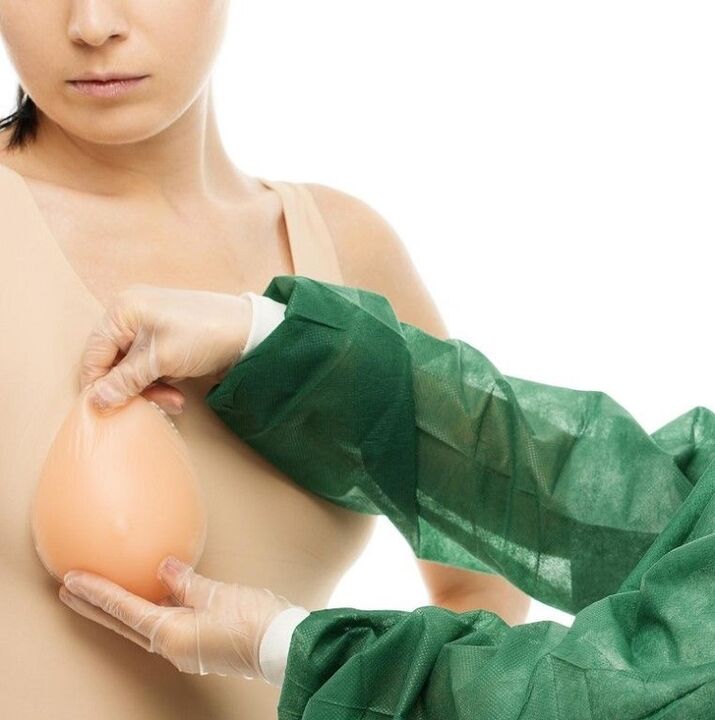 rindade suurendamise implantaadid
